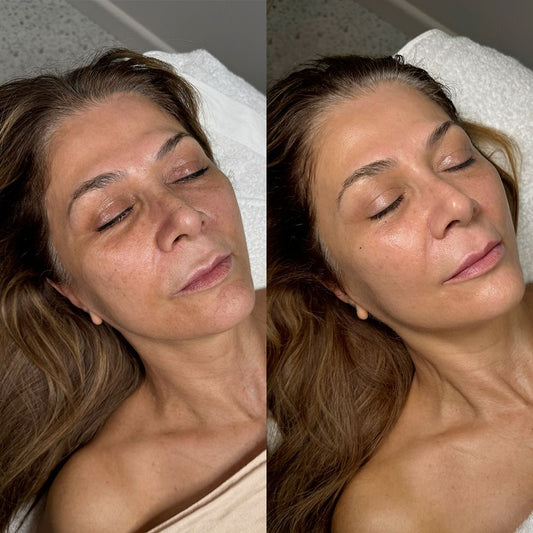 Masque au Bio-Collagène Nayalis™ : 5 raisons pour lesquelles les femmes y reviennent encore et encore